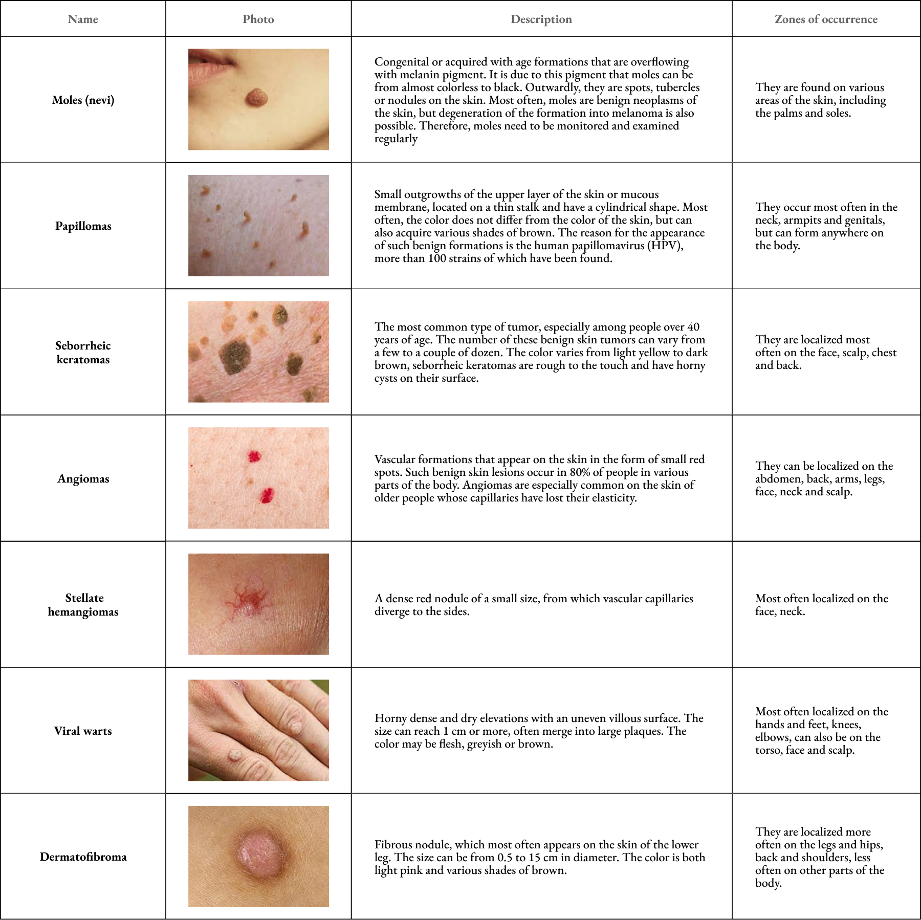 Types of benign skin neoplasms